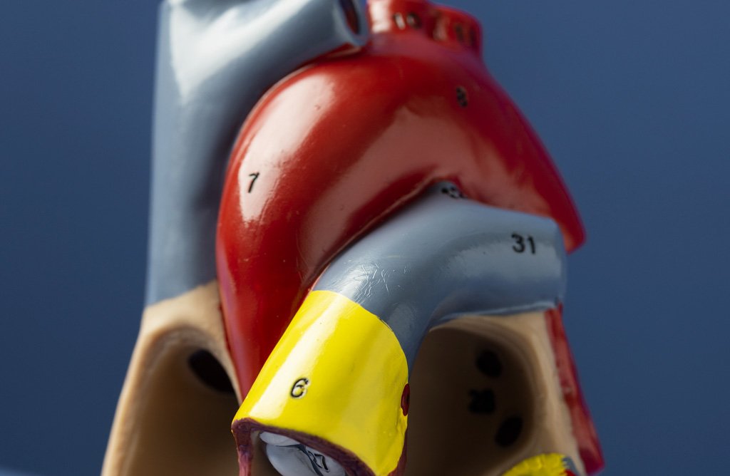 images/Anevrisme-de-l-aorte.jpg#joomlaImage://local-images/Anevrisme-de-l-aorte.jpg?width=1024&height=668