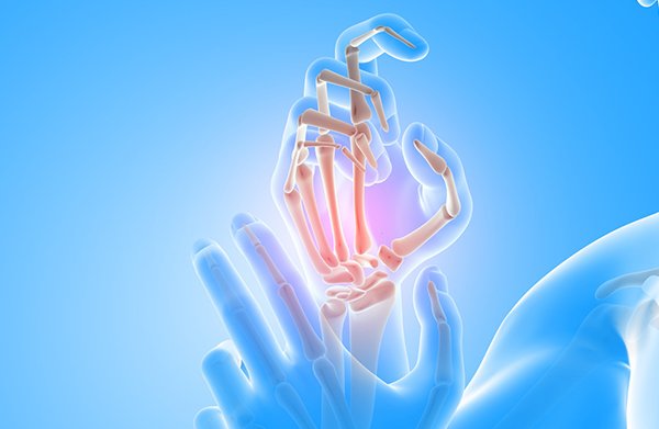 Chirurgie du canal carpien