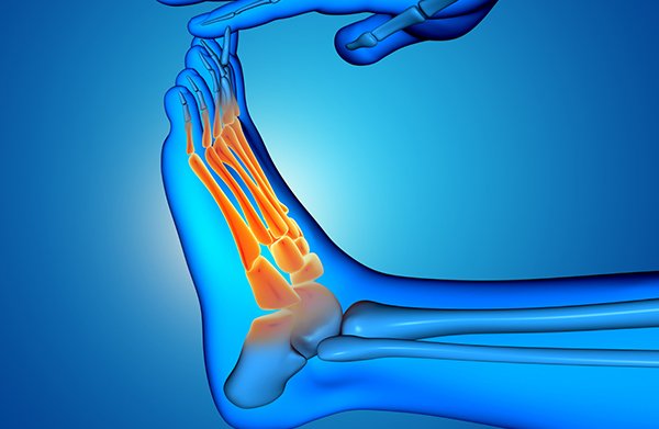 Chiurgie du Hallux valgus