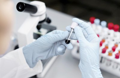 Diagnostic préimplantatoire (DPI)