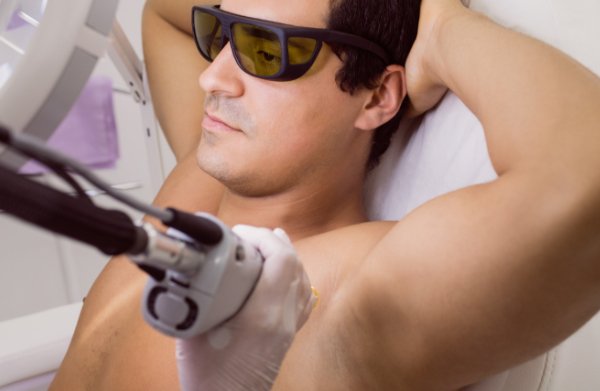 Laser épilatoire des aisselles