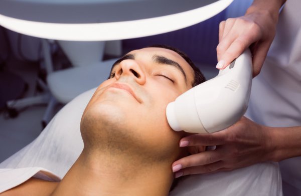 Laser épilatoire du visage