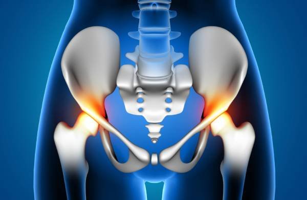 Prothèse totale de la hanche
