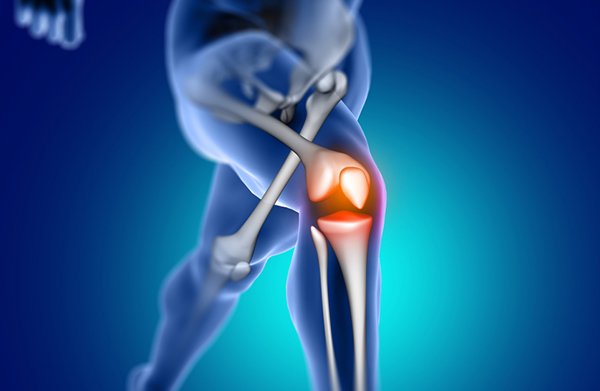 Prothèse totale du genou